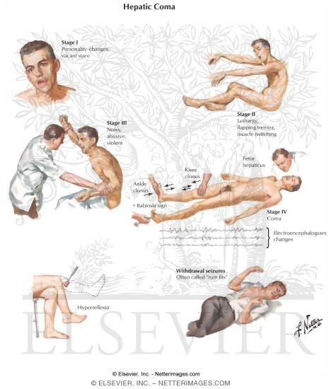 Watermarked preview of labeled image: Serotonergics