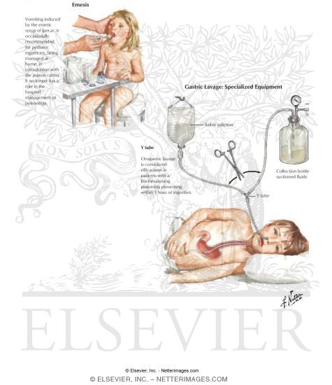 Watermarked preview of labeled image: Management of Poisoning and Overdose
