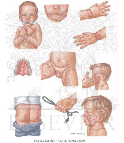 Watermarked preview of unlabeled image: Child Abuse: Injury Patterns