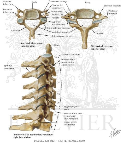 Watermarked preview of labeled image: Vertebrae - Neck