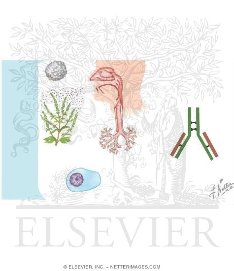 Watermarked preview of unlabeled image: Rhinitis: Allergic and Idiopathic