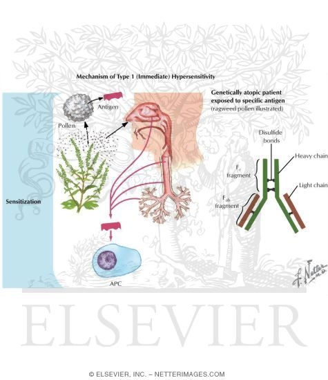 Watermarked preview of labeled image: Rhinitis: Allergic and Idiopathic