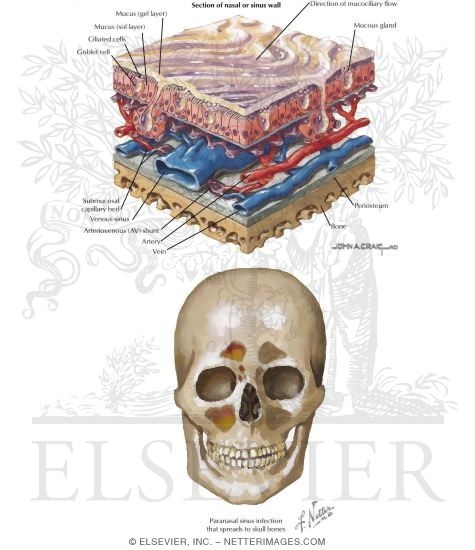 Watermarked preview of labeled image: Overview and Topographic Anatomy of the Paranasal Sinuses