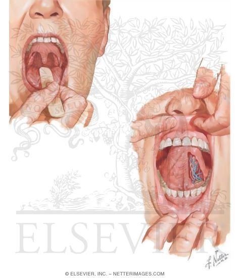 Overview and Topographical Anatomy of the Oral Cavity