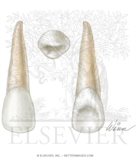 Maxillary Lateral Incisor (Right Side)