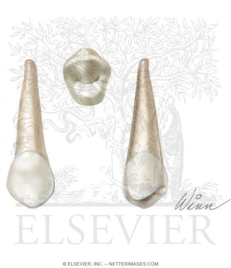 Maxillary 1st Premolar (Right Side)