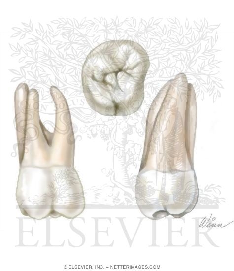 Maxillary 2nd Molar (Right Side)