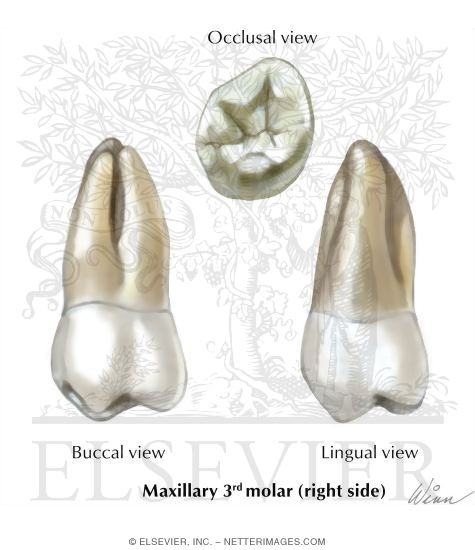 Maxillary 3rd Molar (Right Side)
