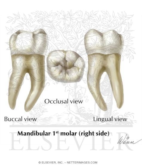 Mandibular 1st Molar (Right Side)