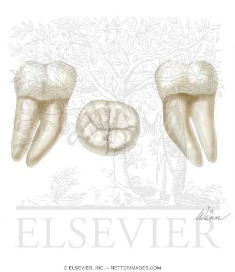 Watermarked preview of unlabeled image: Mandibular 3rd Molar (Right Side)