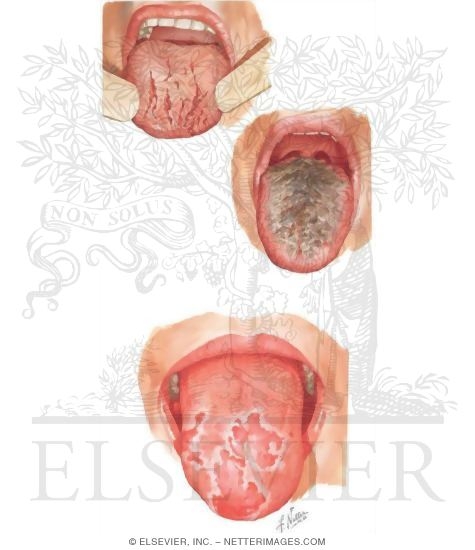 Watermarked preview of unlabeled image: Tongue