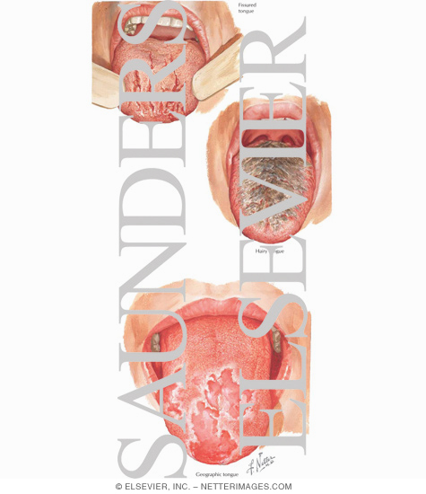 Watermarked preview of labeled image: Tongue