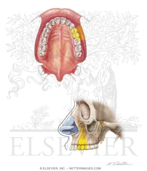 Maxillary Injections: Middle Superior Alveolar Nerve Block