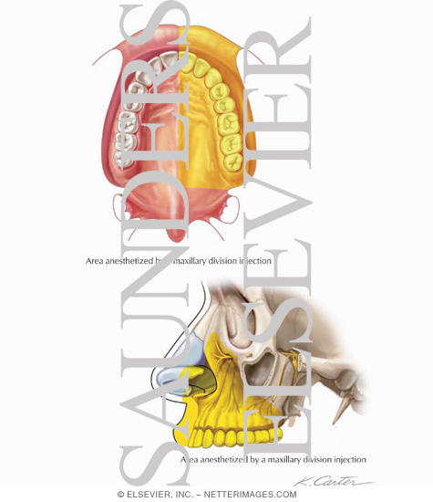 Watermarked preview of labeled image: Maxillary Injections: Maxillary Division Block