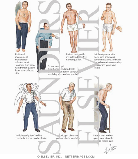 Watermarked preview of labeled image: Gait Examination