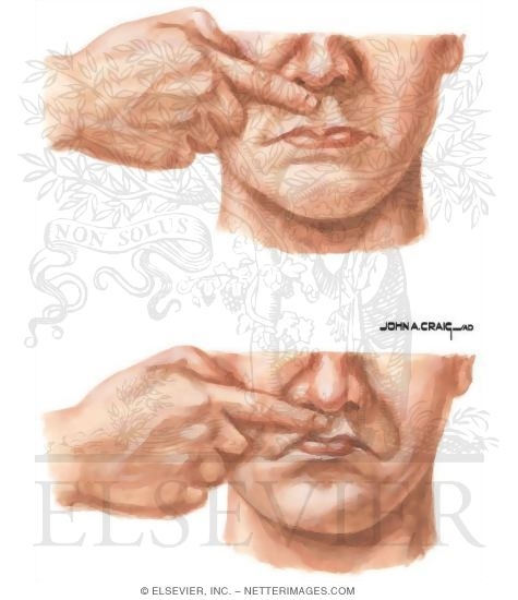 Snout Reflex