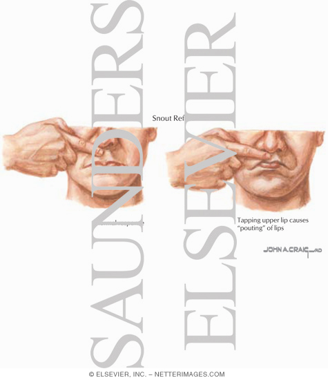 Snout Reflex