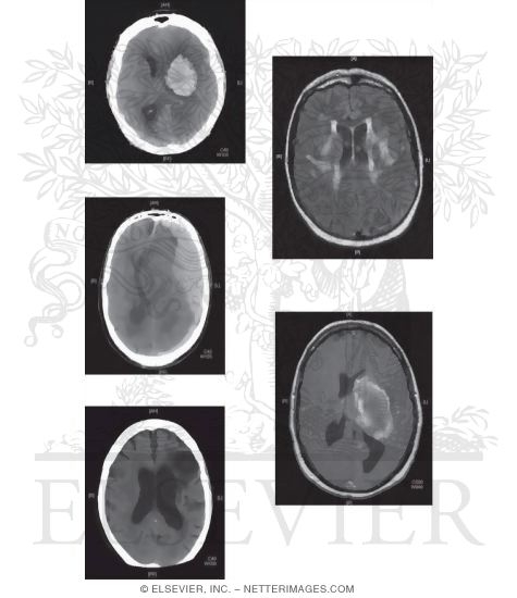 Watermarked preview of unlabeled image: Neurodiagnostic Tests Used for Evaluation