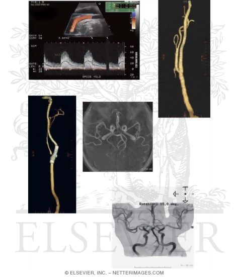 Watermarked preview of unlabeled image: Vascular Imaging