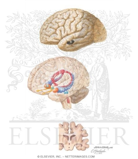 Watermarked preview of unlabeled image: Mental Status: Dementia