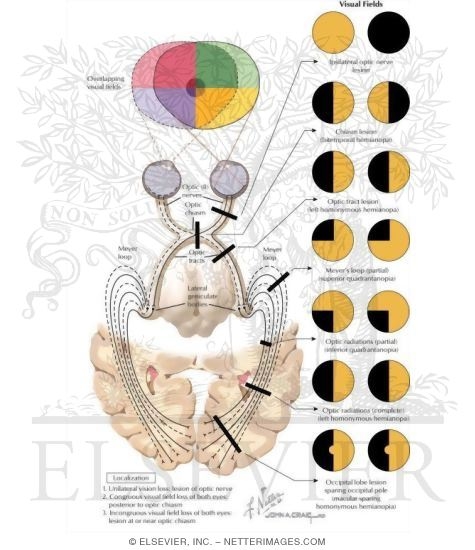 Watermarked preview of labeled image: Sensation: Vision