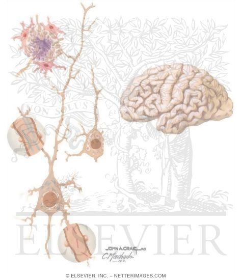 Watermarked preview of unlabeled image: Alzheimer's Disease