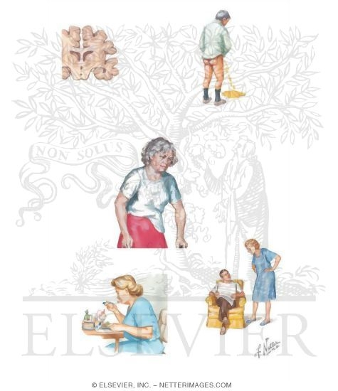 Watermarked preview of unlabeled image: Frontotemporal Dementia