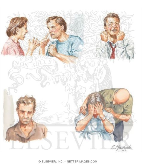 Watermarked preview of unlabeled image: Toxic Encephalopathy