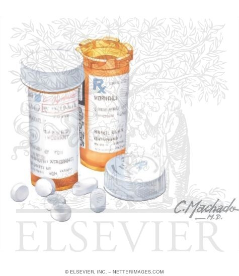 Watermarked preview of unlabeled image: Drug-Induced Parkinsonism