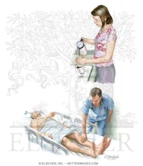 Essential Myoclonus