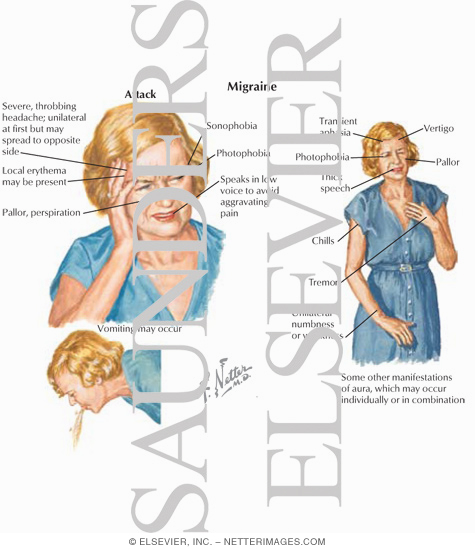 Watermarked preview of labeled image: Migraine Headache