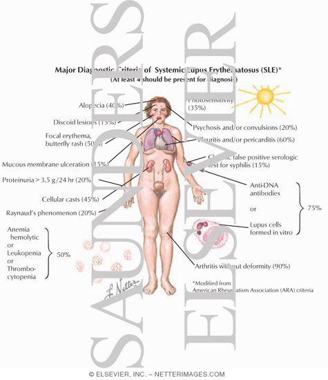 Major Diagnostic Criteria of Systemic Lupus Erythematosus (SLE)
