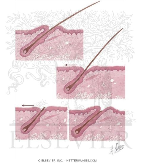 Watermarked preview of unlabeled image: Shaving: A Cause of Skin Disorders