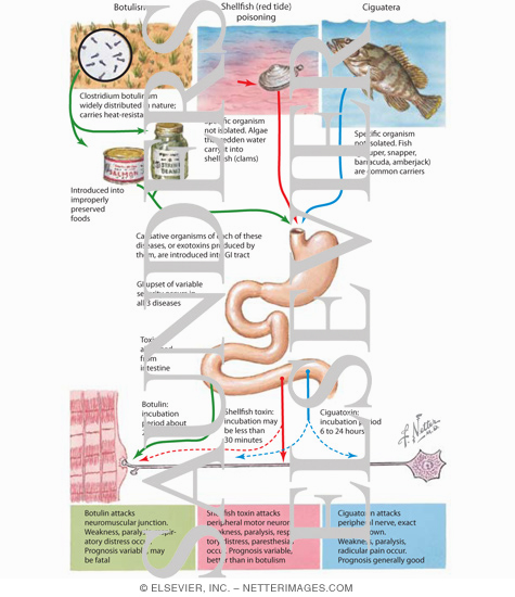 Food-Borne Neurotoxins