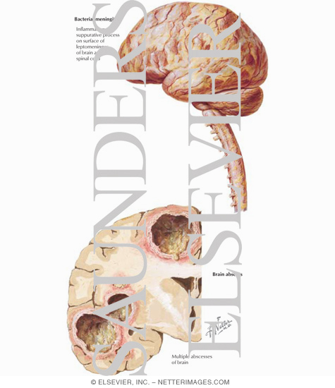 Watermarked preview of labeled image: Overview of Infections