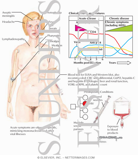 Watermarked preview of labeled image: Human Immunodeficiency Virus (HIV)
