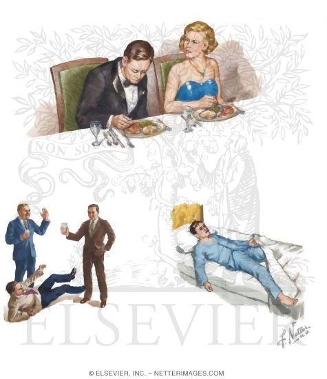 Narcolepsy