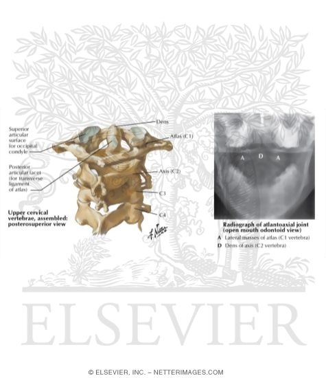 Cervical Vertebrae: Atlas and Axis