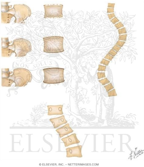 Watermarked preview of unlabeled image: Curvature of the Spine