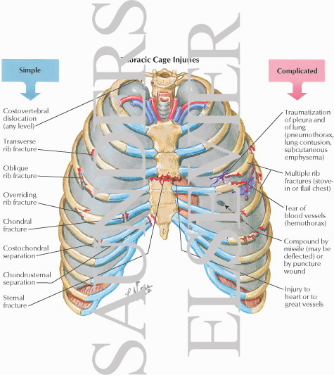 thoracic cage diagram labeled