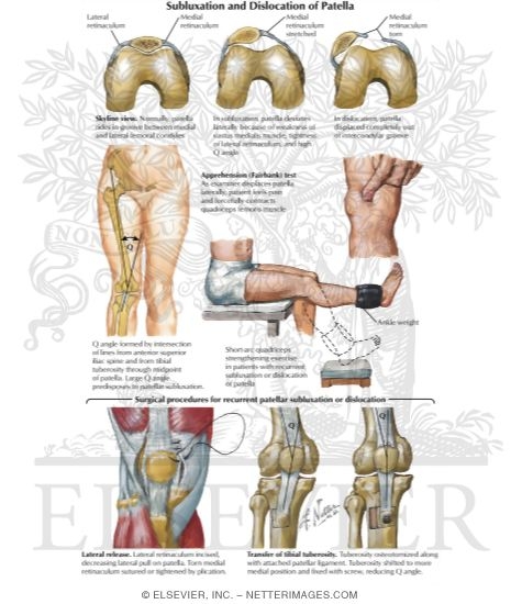 Knee subluxation online