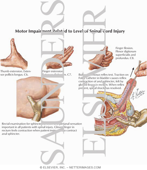 Motor Impairment Related to Level of Spinal Cord Injury