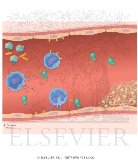 Watermarked preview of unlabeled image: Septicemia