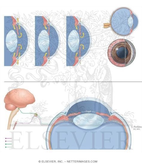 Example of Cholinergic and Adrenergic Drug Treatment: Glaucoma