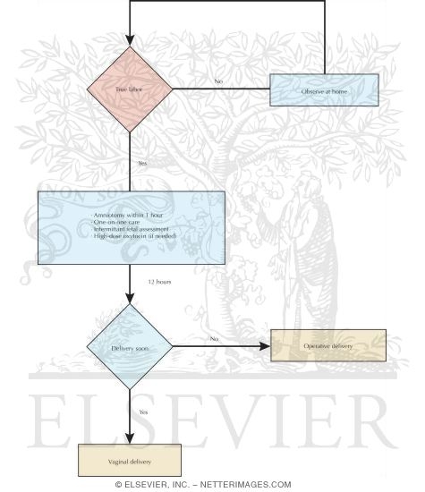 Watermarked preview of unlabeled image: Active Management of Labor
