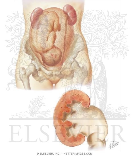 Watermarked preview of unlabeled image: Urinary Complications