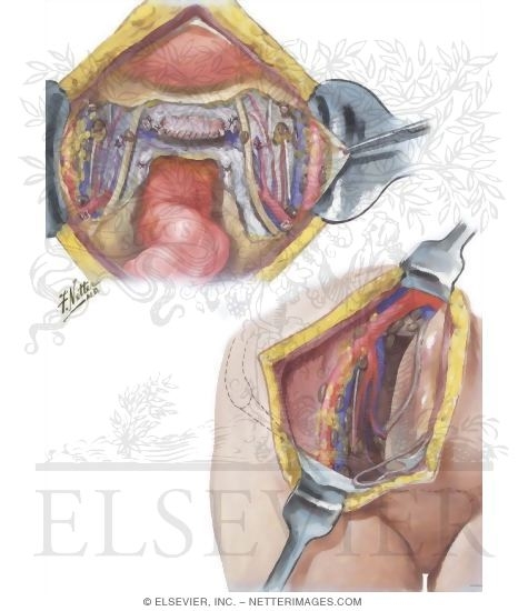 Lymphatic Drainage I - Pelvis
