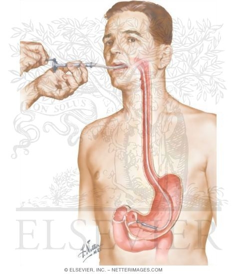 Watermarked preview of unlabeled image: Gastroscopic Diagnosis of Malignant Disease