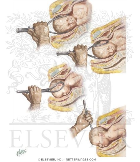 Watermarked preview of unlabeled image: Rotation and Delivery