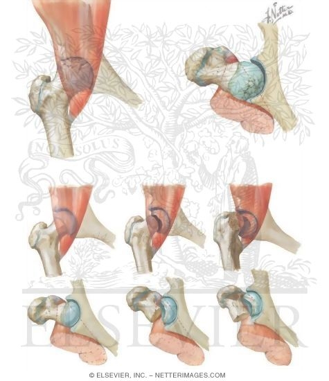 Watermarked preview of unlabeled image: Osteochondrosis of Capital Epiphysis